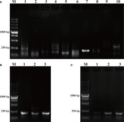 Establishment of methods for rapid detection of Prymnesium parvum by recombinase polymerase amplification combined with a lateral flow dipstick